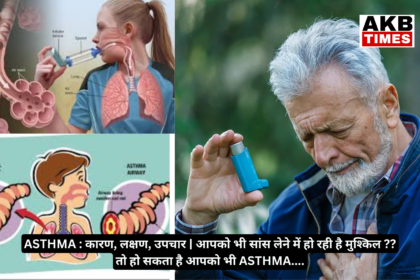 ASTHMA