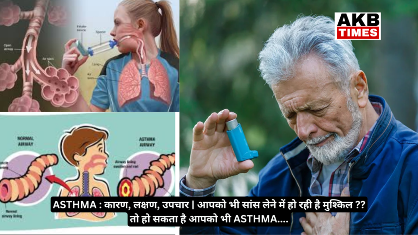 ASTHMA