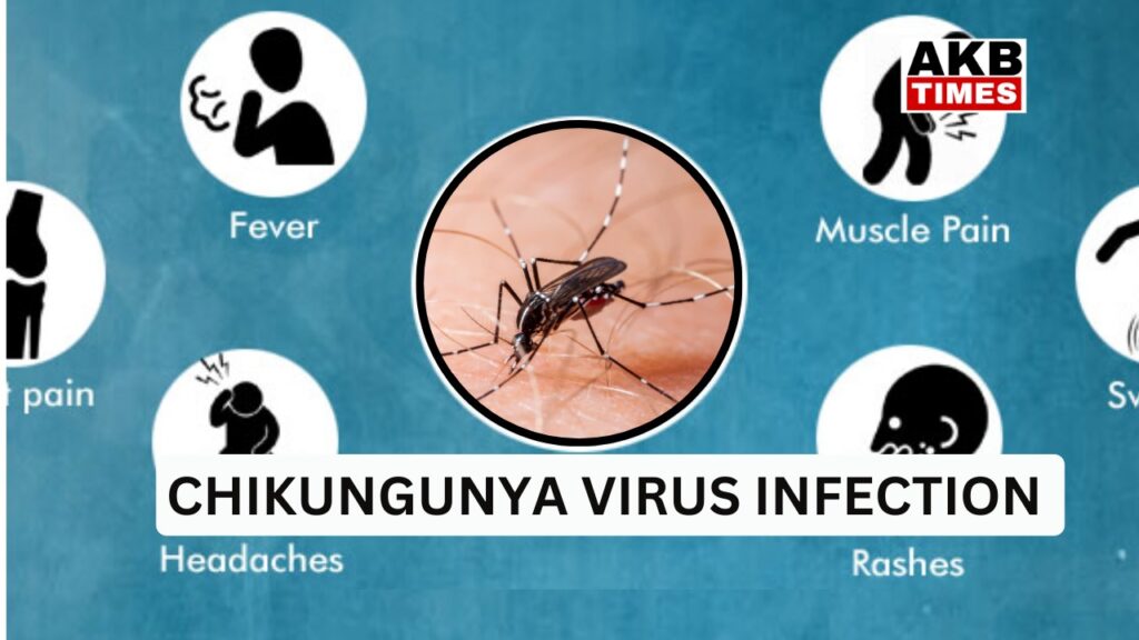 CHIKUNGUNYA VIRUS INFECTION : Joints में दर्द पैदा करता है यह  infection , ज्यादा तर होता है उम्र वाले लोगों में |