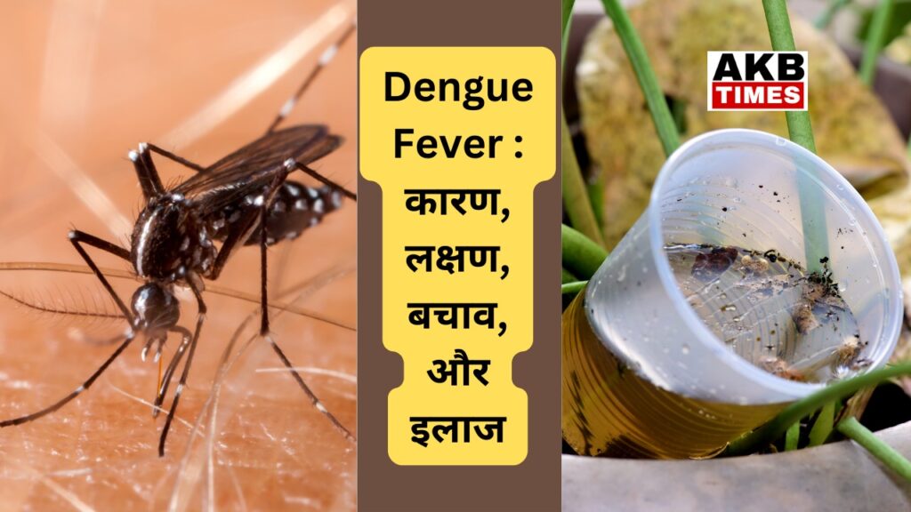 Dengue एक ऐसा viral infection है जो की मच्छर के काटने से होता है ।